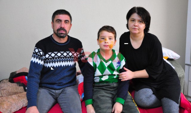 Köpek saldırısına uğrayan Mert'in yüzüne 60 dikiş atıldı