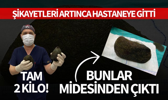 Şikayetleri artınca hastaneye gitti: Bunlar midesinden çıktı! Tam 2 kilo