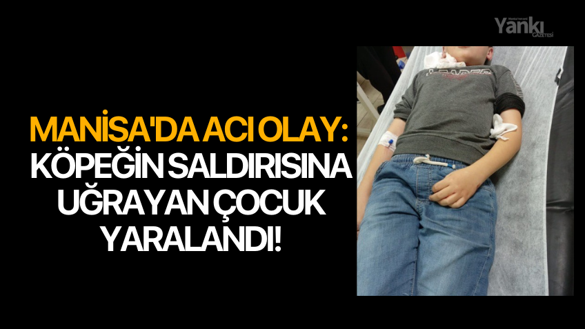 Manisa'da acı olay: Köpeğin saldırısına uğrayan çocuk yaralandı!