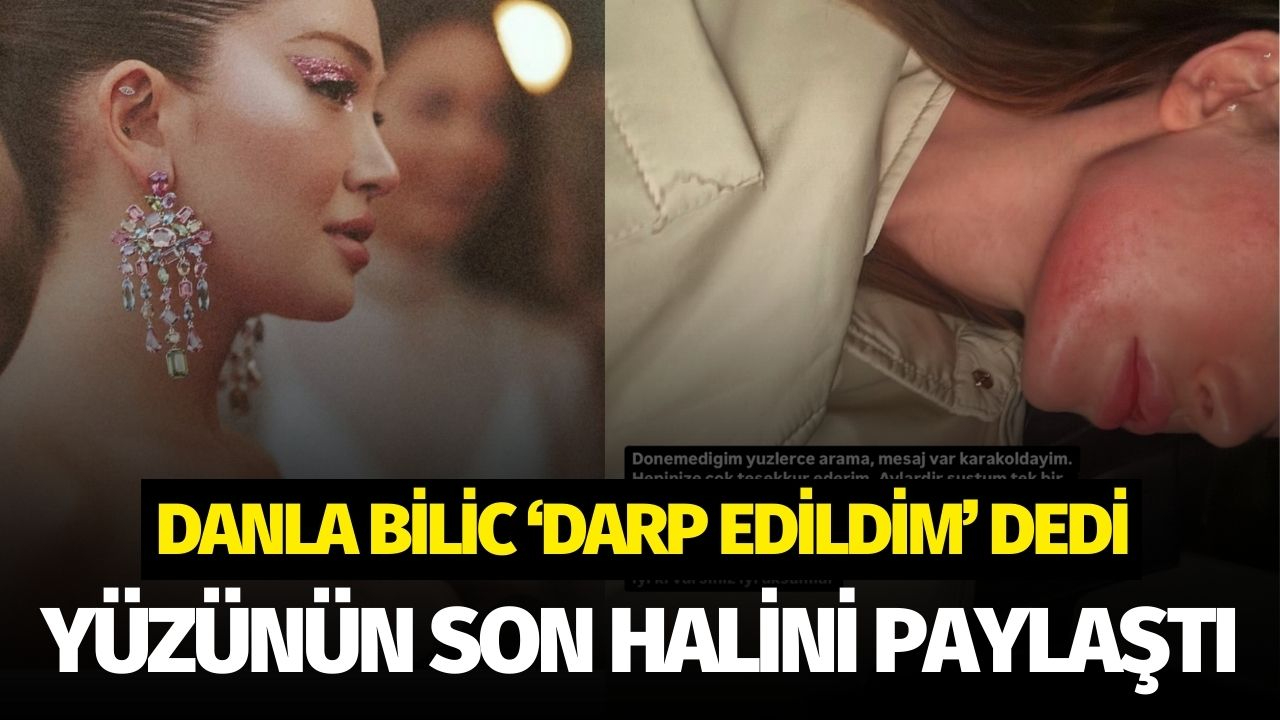Danla Bilic darp edildim dedi, yüzünün son halini paylaştı