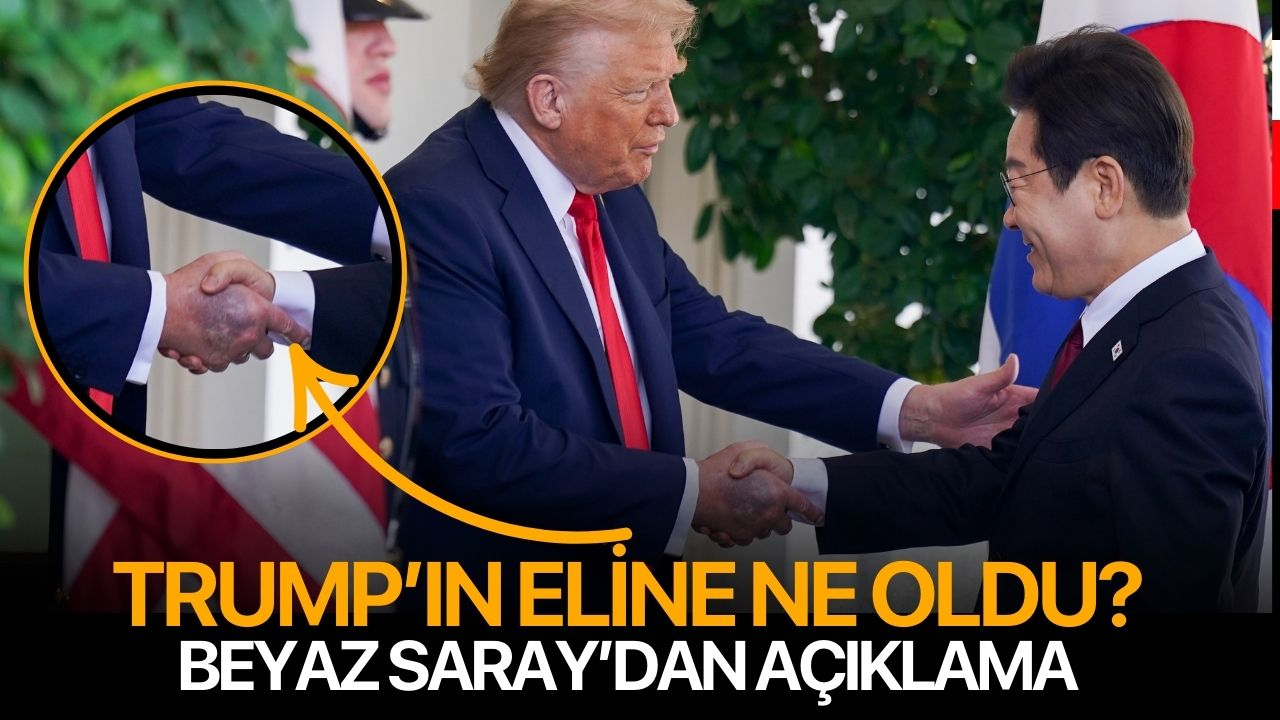 Trump'ın eline ne oldu? Beyaz Saray'dan açıklama