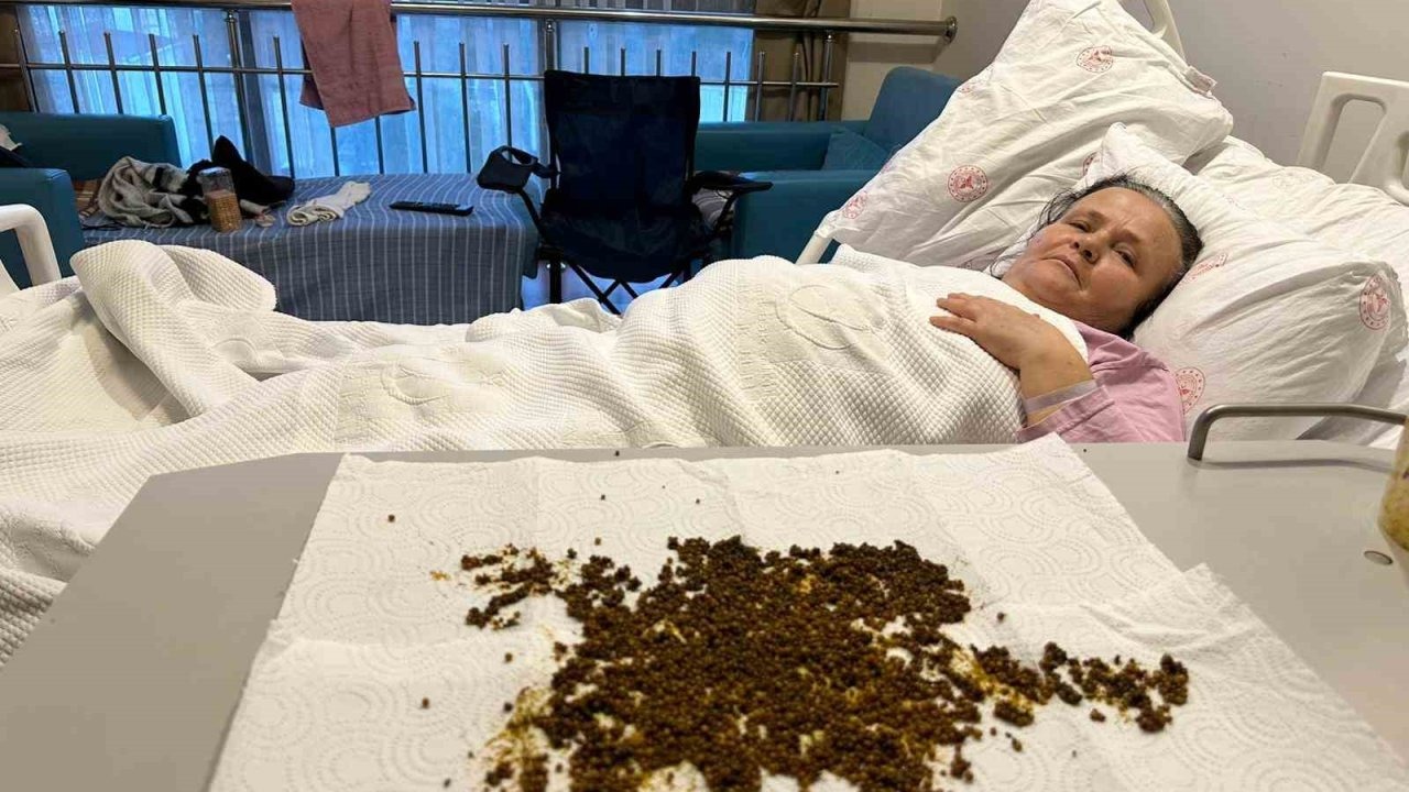 Manisa'da 70 yaşındaki hastadan 20 binin üzerinde taş çıktı