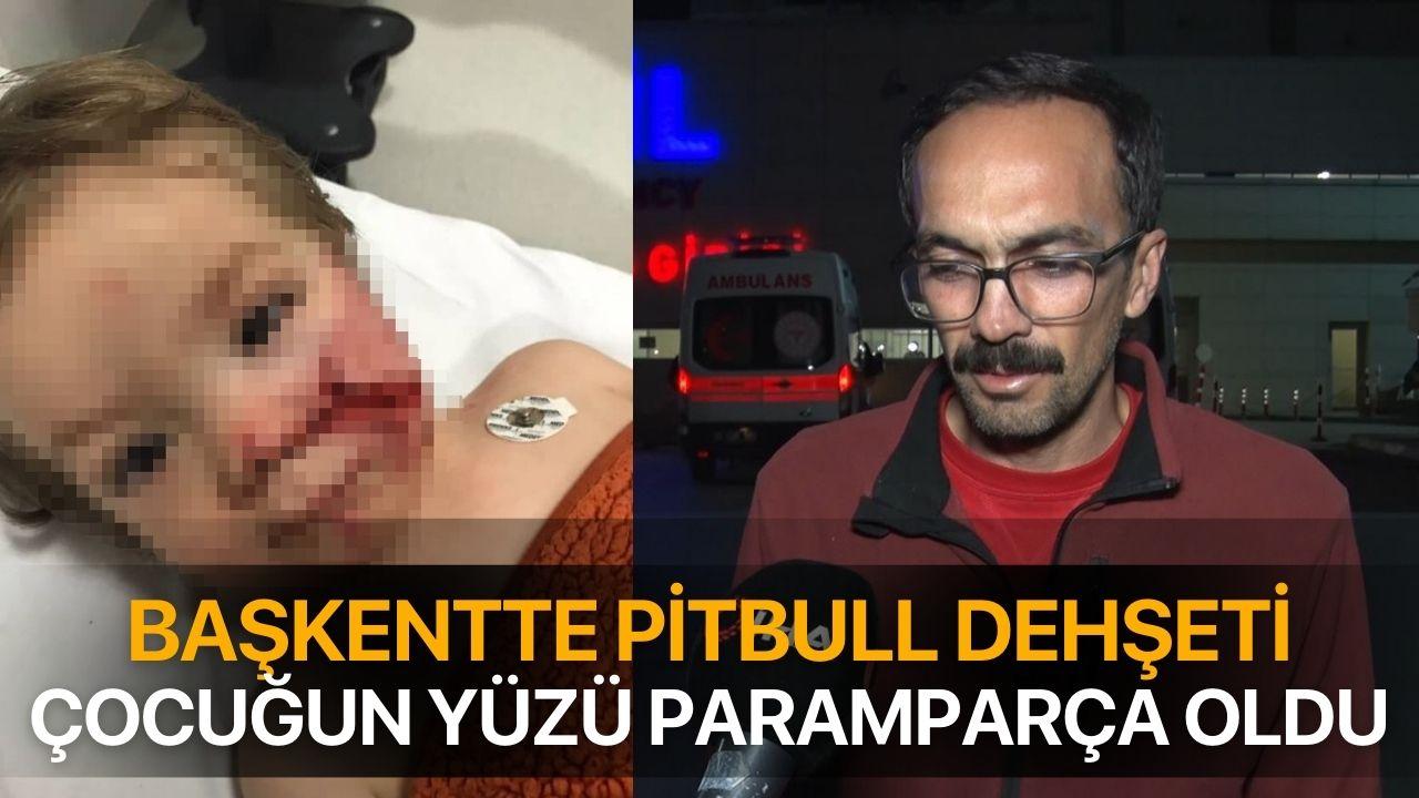 Başkentte pitbull dehşeti! Çocuğun yüzü paramparça oldu