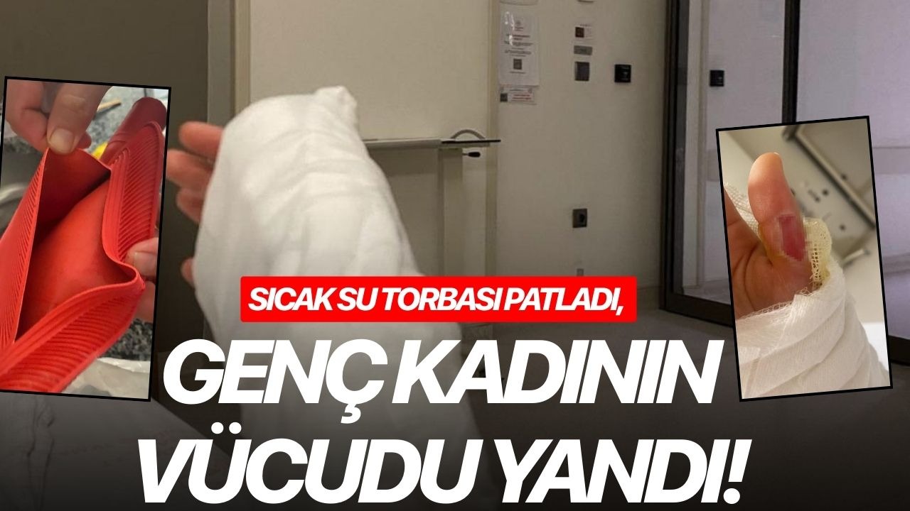 Sıcak Su Torbası Patladı, Genç Kadının Vücudu Yandı!