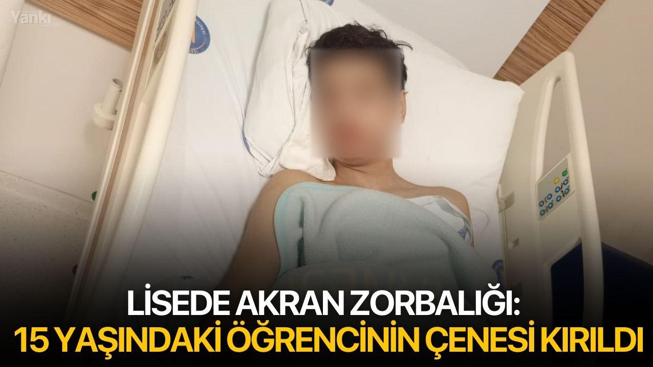 Lisede akran zorbalığı: 15 yaşındaki öğrencinin çenesi kırıldı