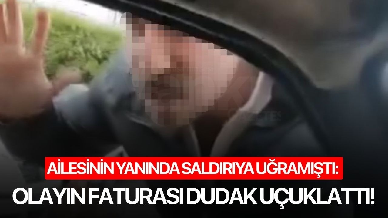 Ailesinin yanında saldırıya uğramıştı: Olayın faturası dudak uçuklattı!