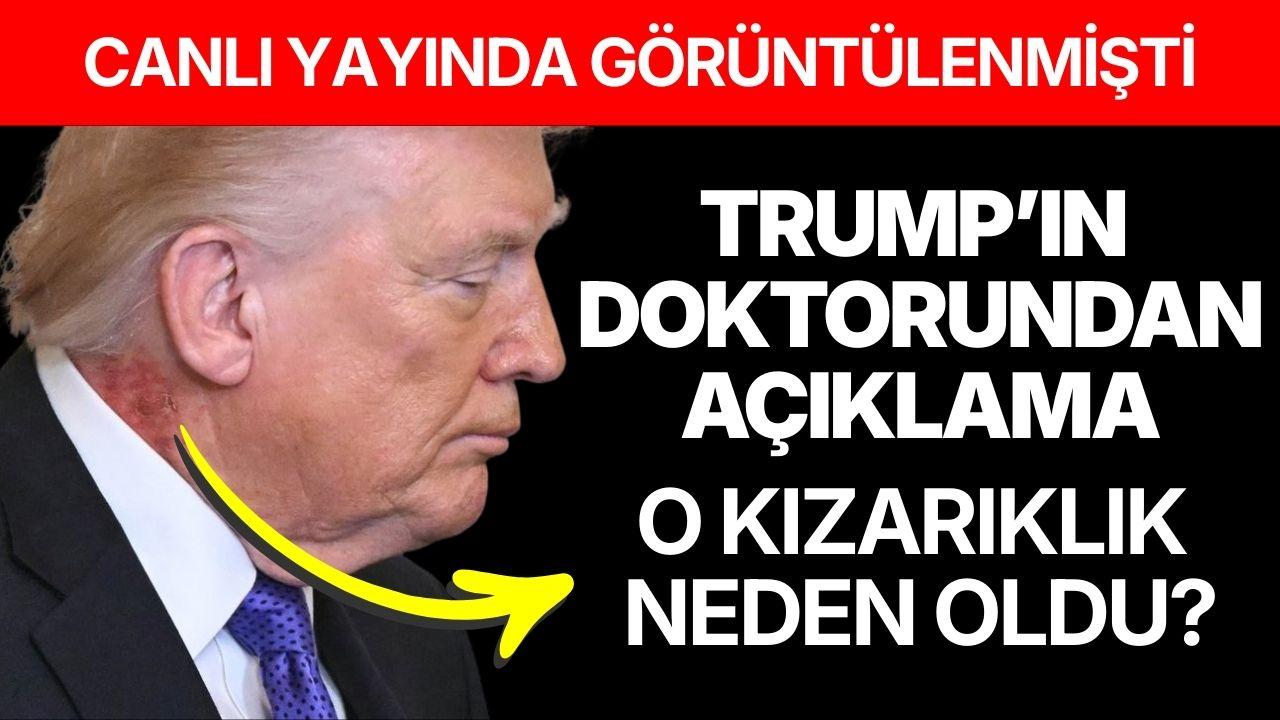 Trump’ın boynundaki kızarıklık hakkında doktorundan açıklama