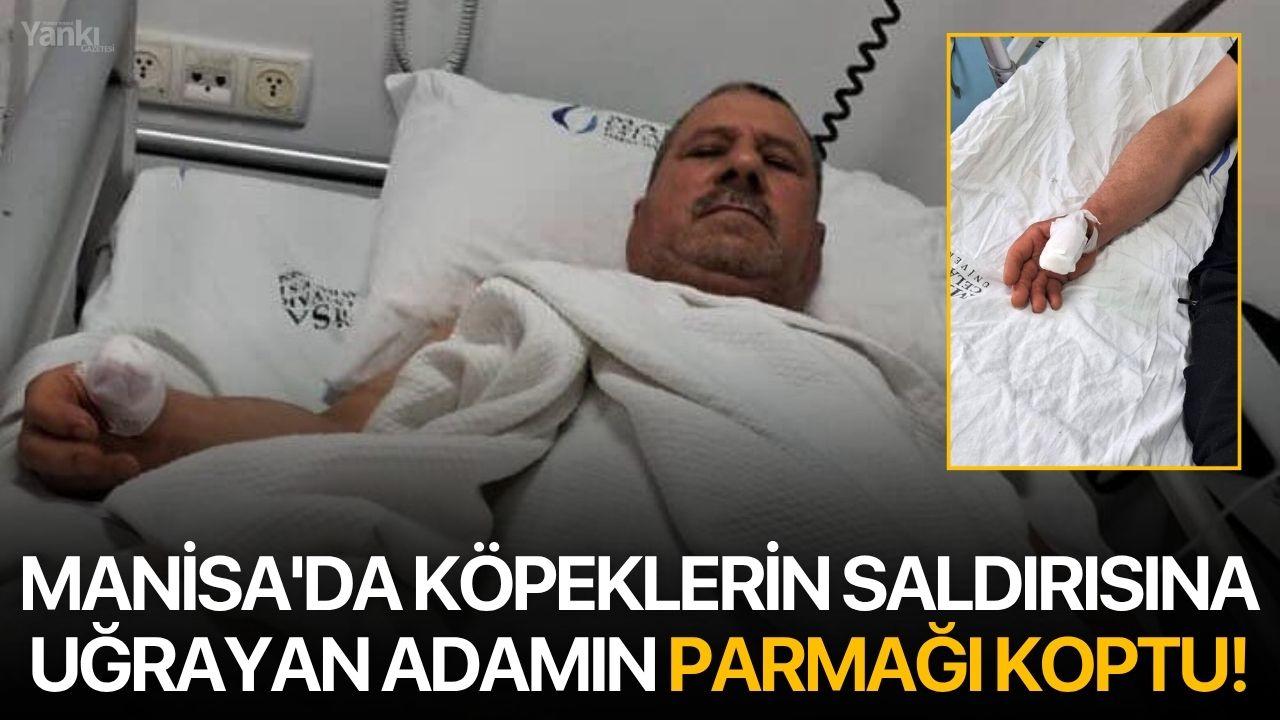 Manisa'da köpeklerin saldırısına uğrayan adamın parmağı koptu!