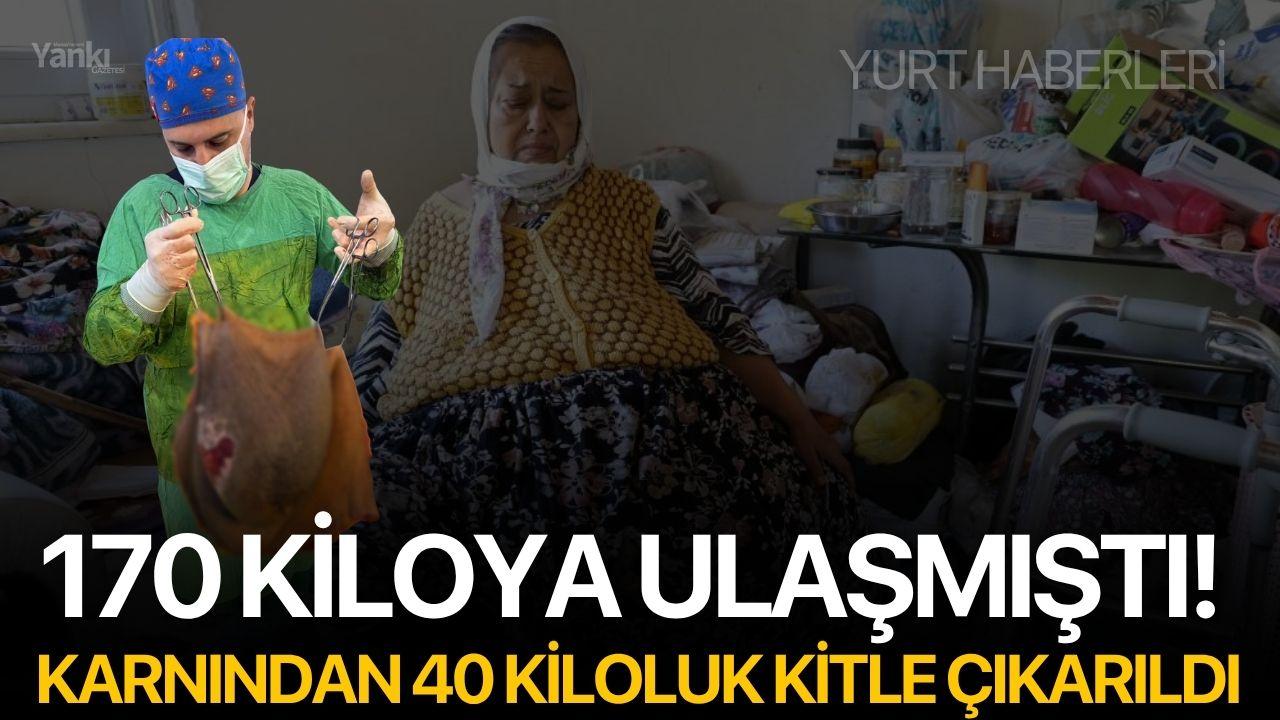 170 Kiloya Ulaşmıştı! Karnından 40 Kiloluk Kitle Çıkarıldı