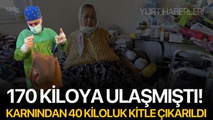 170 Kiloya Ulaşmıştı! Karnından 40 Kiloluk Kitle Çıkarıldı